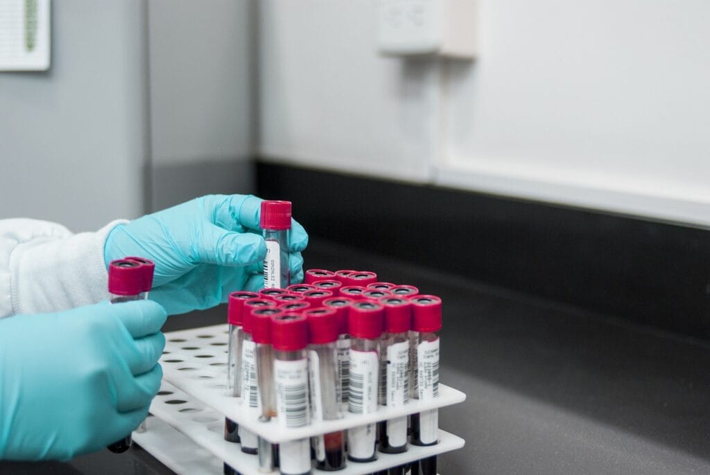 Best home hormone test